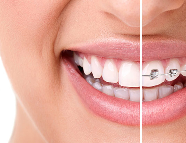 orthodontiki