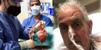Πρώτη φορά: Μεταμόσχευση καρδιάς χοίρου σε 57χρονο Αμερικανό