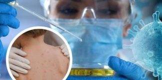 ΠΟΥ: Επιδημίες, όπως της ευλογιάς των πιθήκων, γίνονται συχνότερες